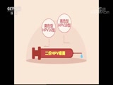 ʾ 20180506 HPV絽